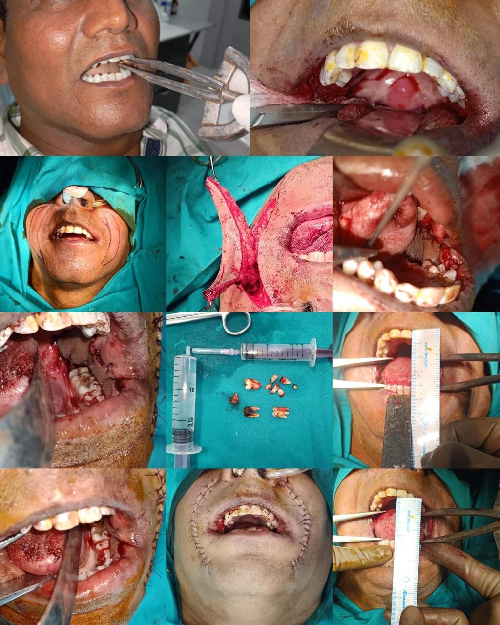 maxillofacial